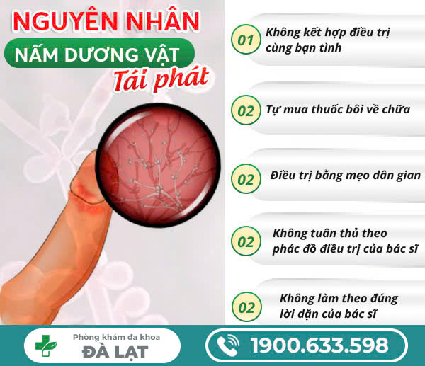 Hình ảnh minh họa